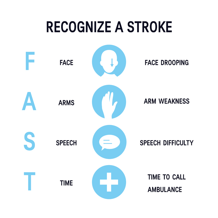 Recognize a stroke